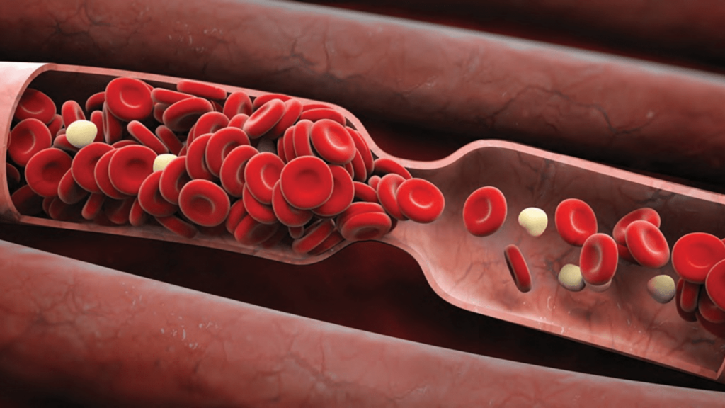 La campaña del Día Mundial de la Trombosis reúne a miles de socios en todo el mundo para llamar la atención sobre los coágulos sanguíneos como un problema de salud urgente