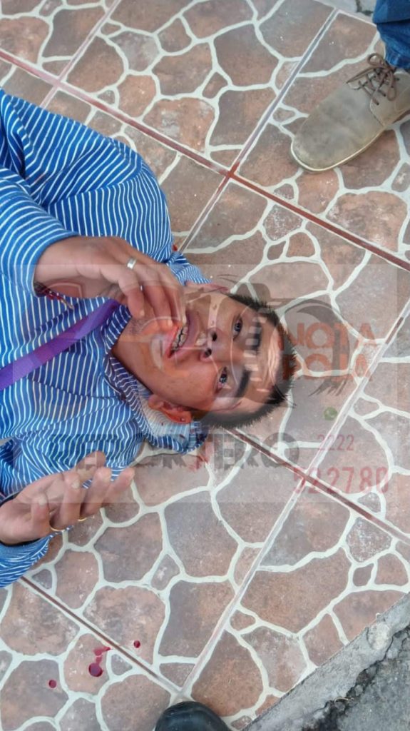 Vecinos de Texmelucan detienen y golpean a presunto ladrón