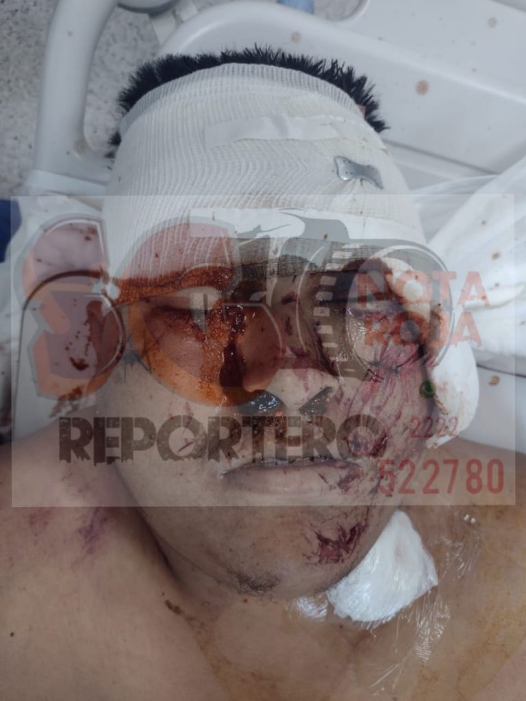 Hombre muere en hospital por navajazos de presunto delincuente en Hueytamalco