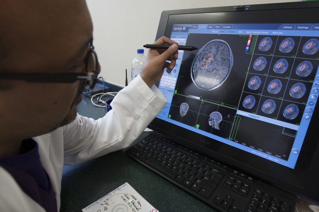 Cifras de cáncer se disparan en medio de la pandemia