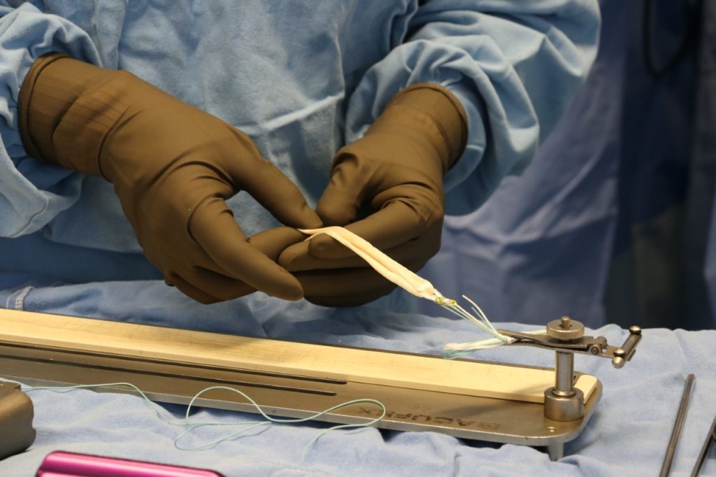 Recibe derechohabiente injerto cadavérico de tejido músculo esquelético