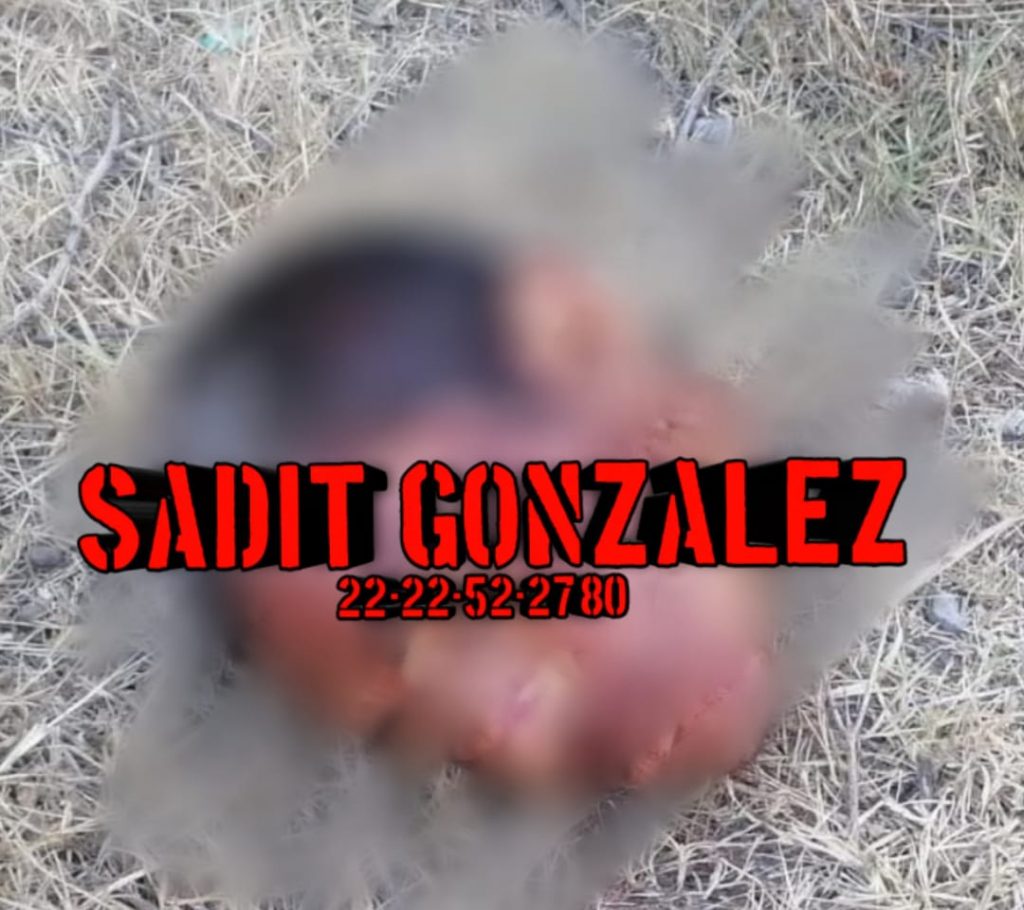 Hallan desmembrado en Yehualtepec