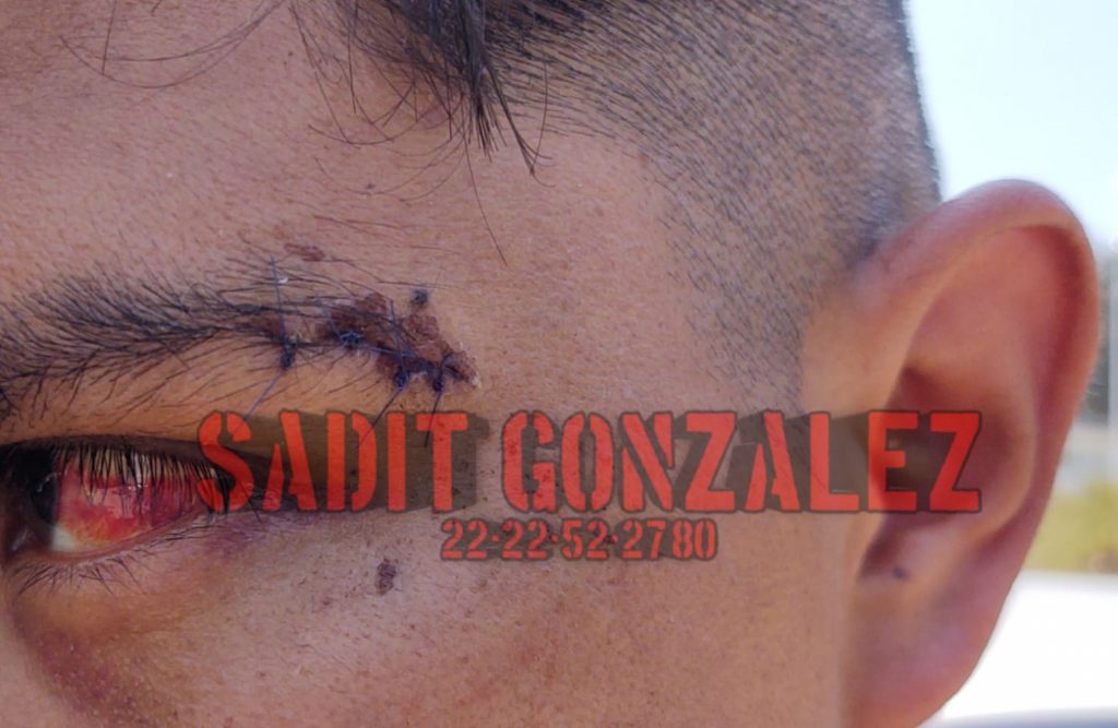 Fotonota: Acusan a policías de Pahuatlán de abuso de autoridad