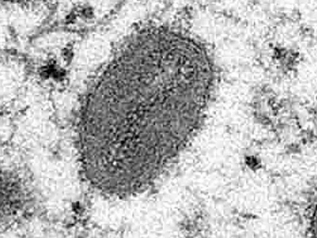 Así luce el virus de la viruela del mono en el microscopio