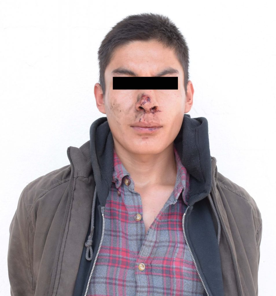 Detuvieron a los 5 acusados de asalto en zona de las Ánimas