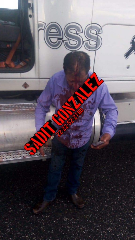 Balean a camionero en intento de asalto sobre la Puebla-Orizaba