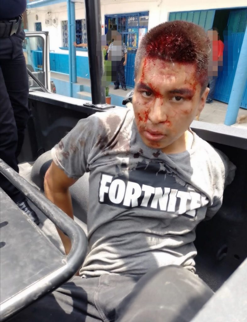 Desde Huauchinango: Vecinos fracturan a ratero por asaltar transporte colectivo