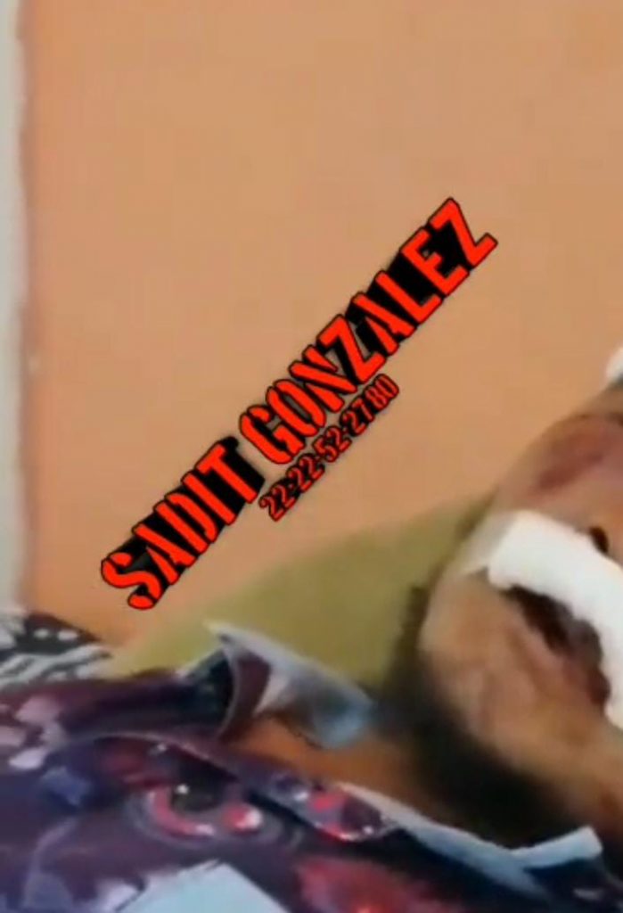 Acusan a policías auxiliares de San Pedro Acoquiaco de abuso de autoridad e intentó de homicidio