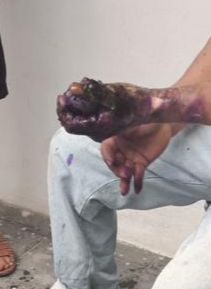 Explosión de pirotecnia en Santiago Miahuatlán deja dos personas lesionadas