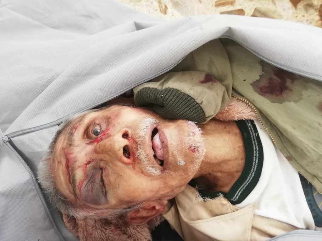 Piden localizar a familiares de octogenario atropellado en la México Tuxpan