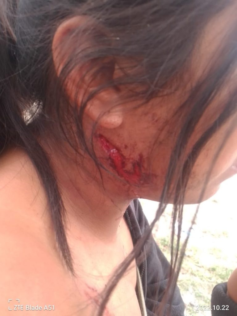 Perro ataca a una niña y la lesiona en el cuello en Tehuacán