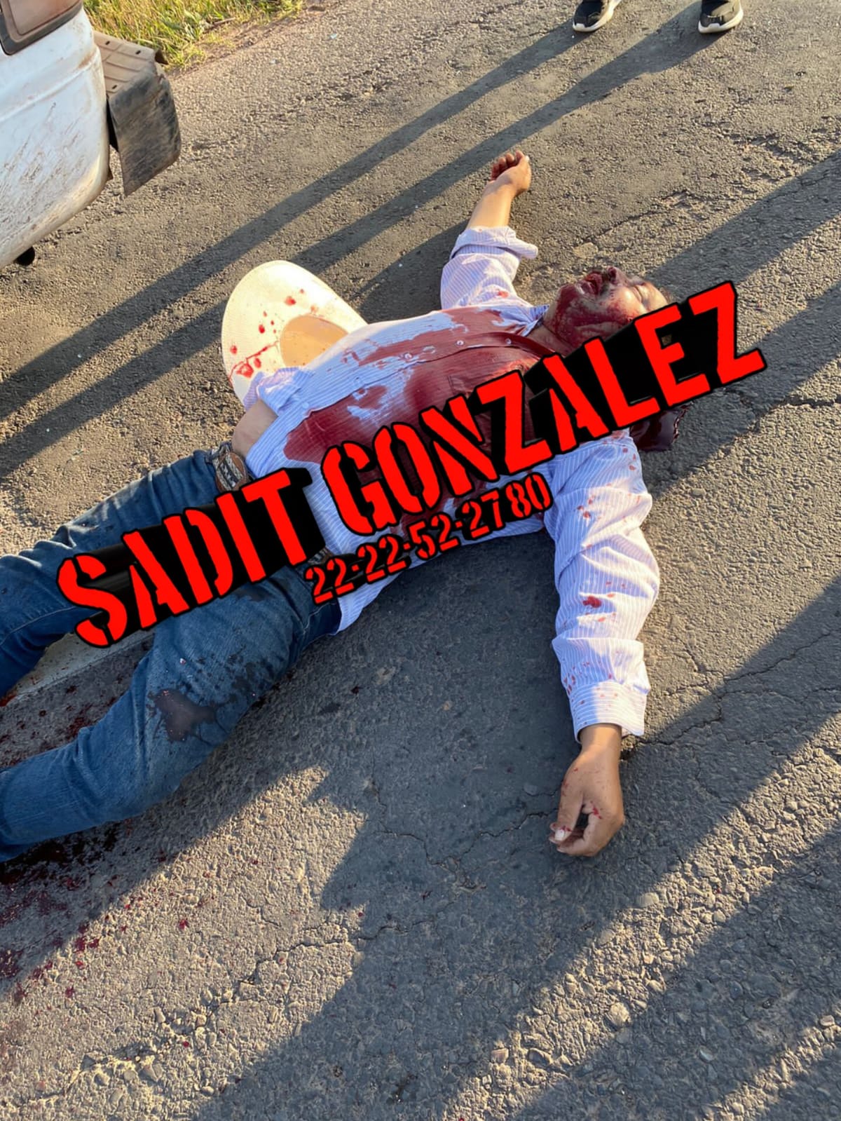 Entre la vida y la muerte, hombre atacado a balazos en Zacatlán