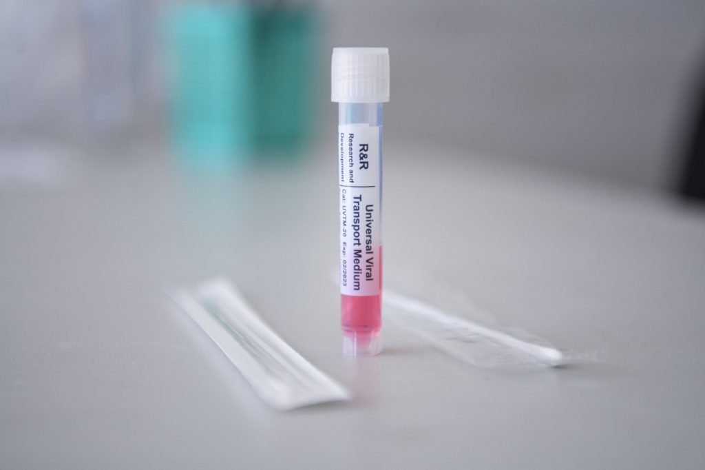 Puebla registró 177 contagios y un deceso más por covid-19