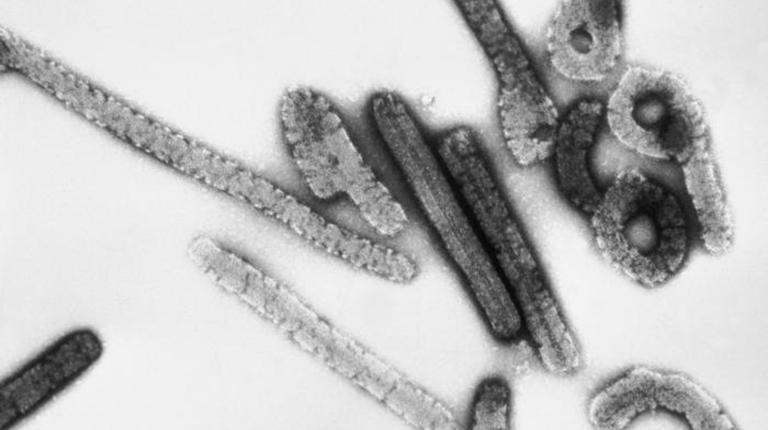 Detectan brote de virus de Marburgo en África y la OMS se prepara para una nueva pandemia