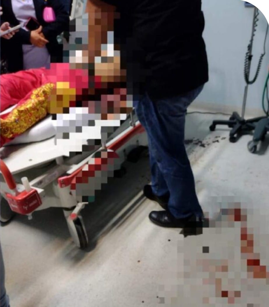 Menor de edad falleció supuestamente por heridas recibidas durante el carnaval de Huejotzingo