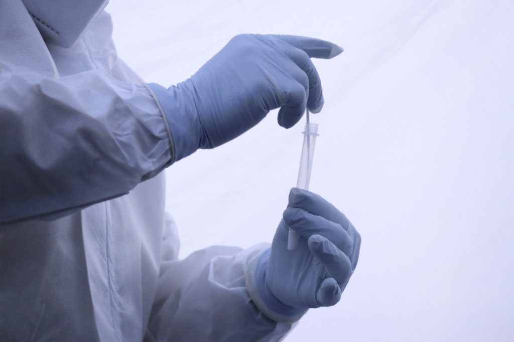 Parte de Guerra Puebla: Día del Amor con mil 311 enfermos covid vigentes en.la entidad