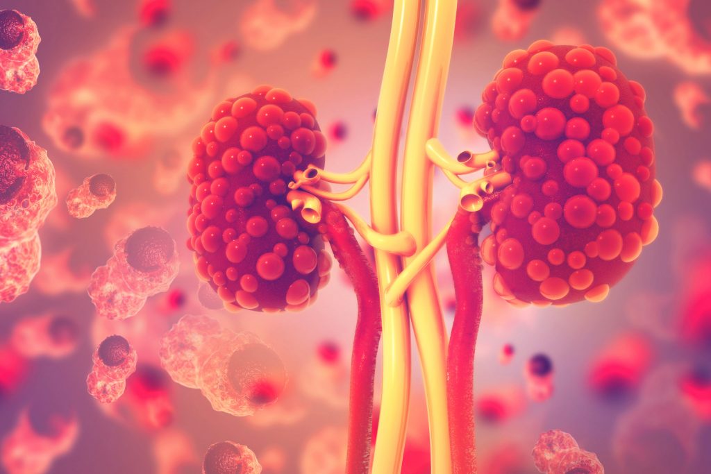 Bayer lanza nueva molécula para el tratamiento temprano de la enfermedad renal, además de prevenir eventos cardiovasculares en pacientes con diabetes tipo 2