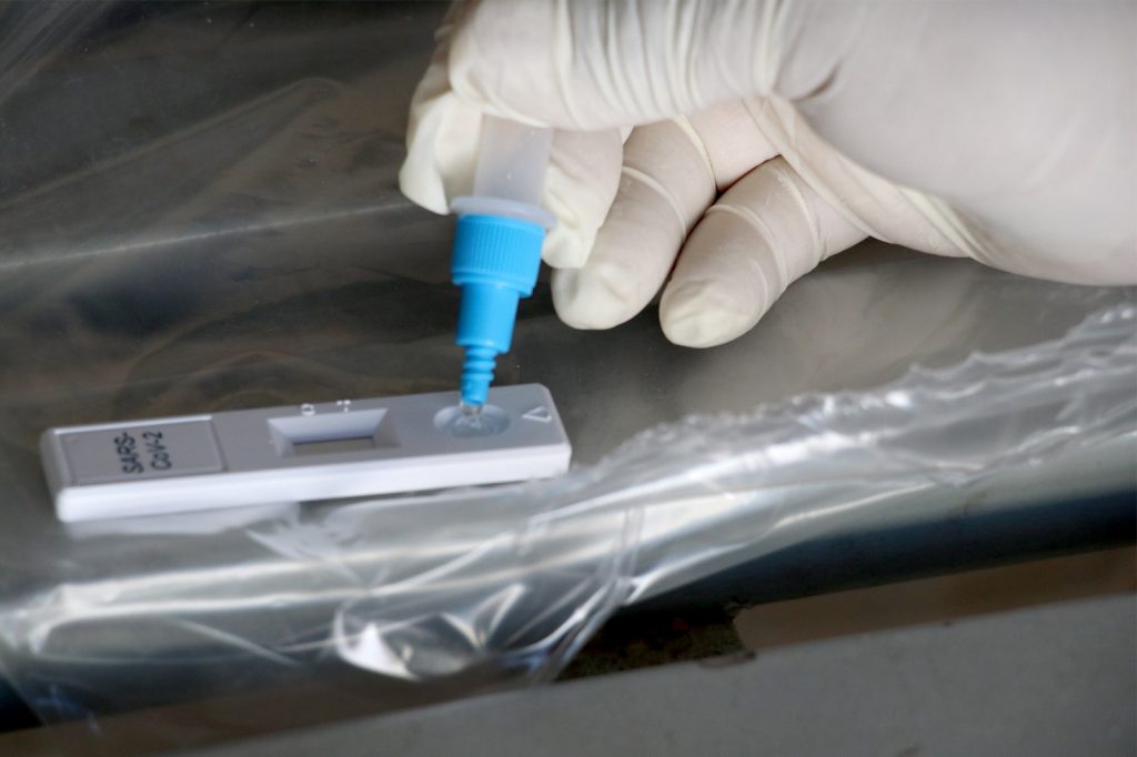 Puebla acumuló ayer 36 enfermos Covid