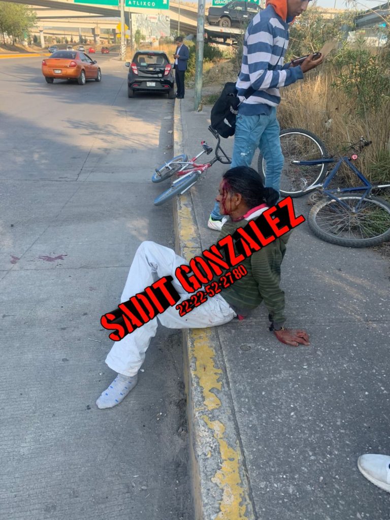Atropellan a ciclista en Amozoc