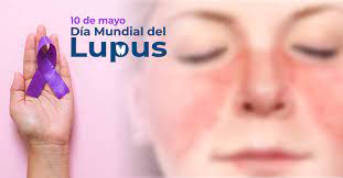 World Lupus Federation insta a la comunidad global a generar concientización sobre el lupus el 10 de mayo por el Día Mundial del Lupus 2023