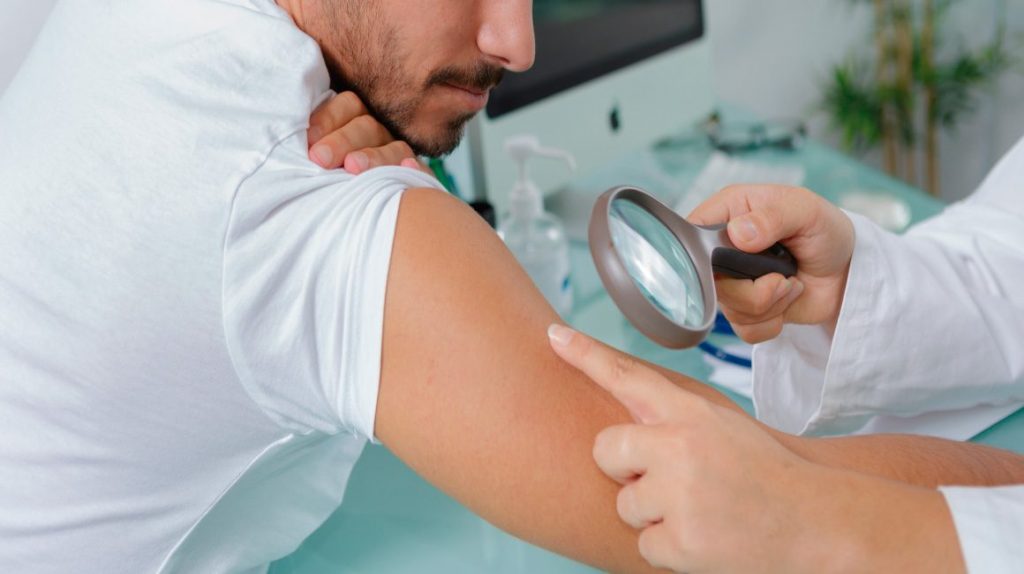 Pelones, 30% de los hombres: Fundación Mexicana para la Dermatología