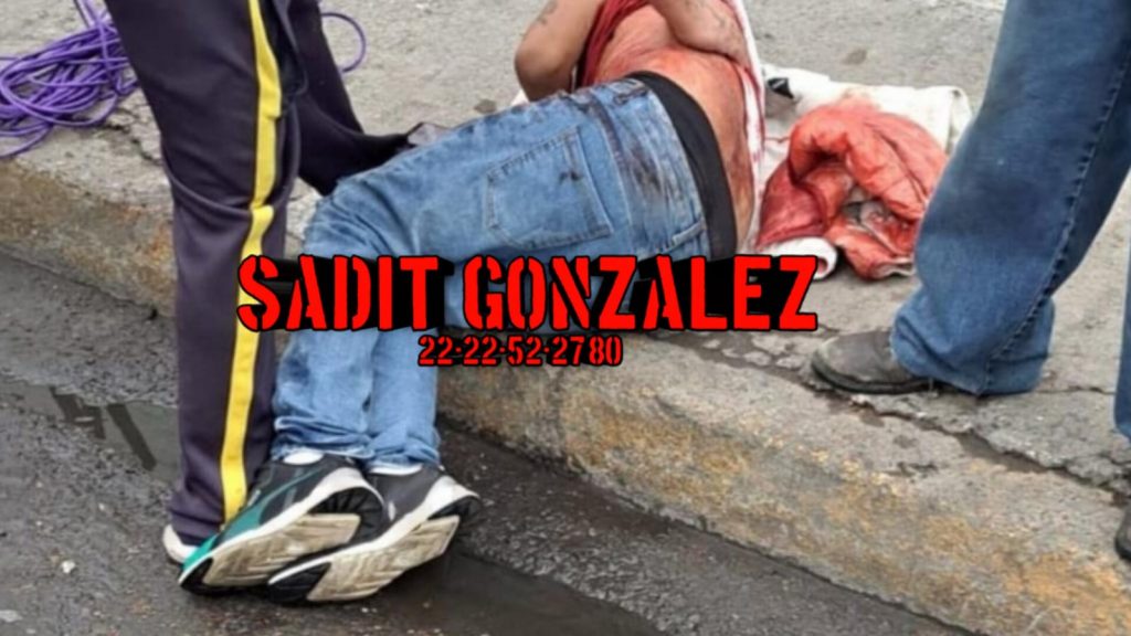 En plena vía pública, balean a joven en la unidad habitacional Loma Bella