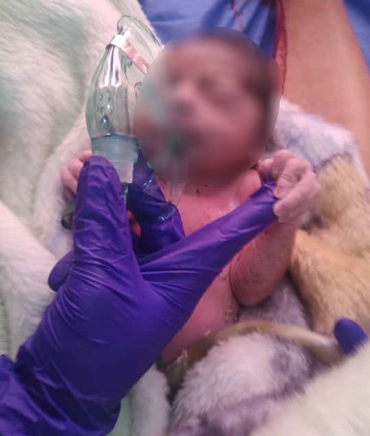 Nace un bebé en ambulancia en Zacatlán