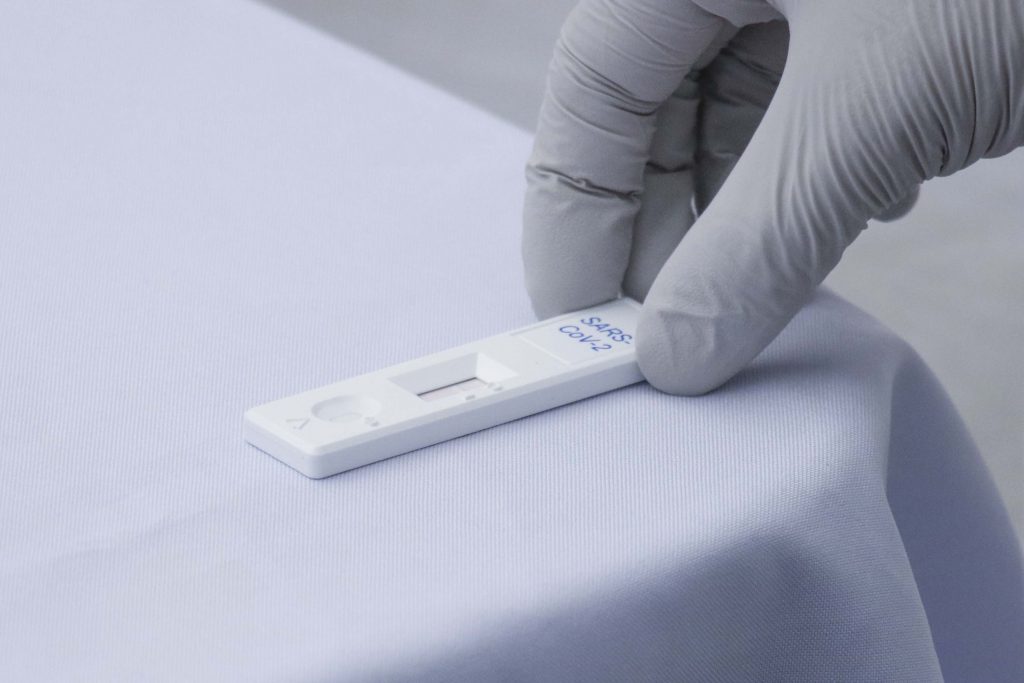 Reporta Salud estatal casos activos de coronavirus en Puebla