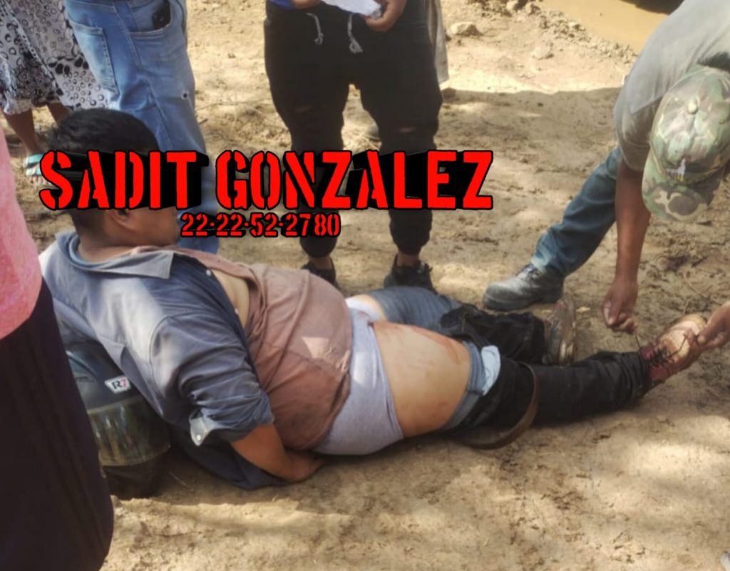 Balean a repartidor de pizzas para asaltarlo en Chachapa, Amozoc