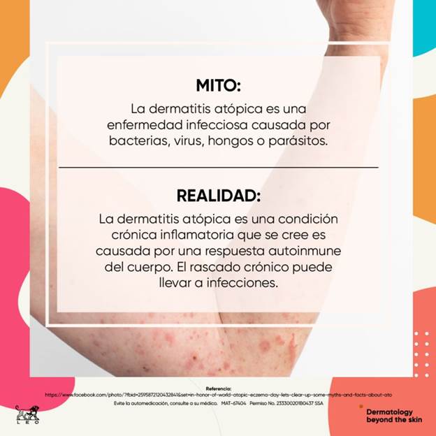 Este mes de agosto Dermatitis atópica afecta desempeño escolar en infantes; fundamental detectarla y tratarla oportunamente, alertan especialistassan a clases 24 millones de estudiantes de educación básica