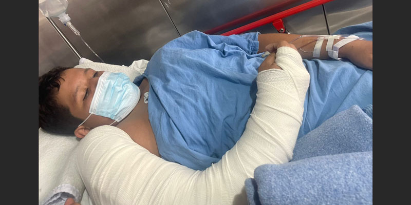 Por falta de recursos ISSSTE Acapulco prefiere amputar brazo a niño accidentado