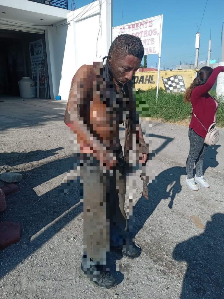 Fotonota: Quemado en casi todo el cuerpo, lo encuentran en carretera de Izúcar