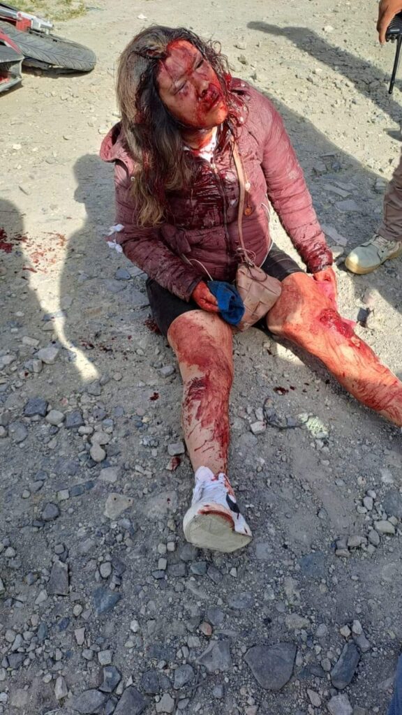 Sendos accidentes de motociclistas en Cuapiaxtla y Acatlán