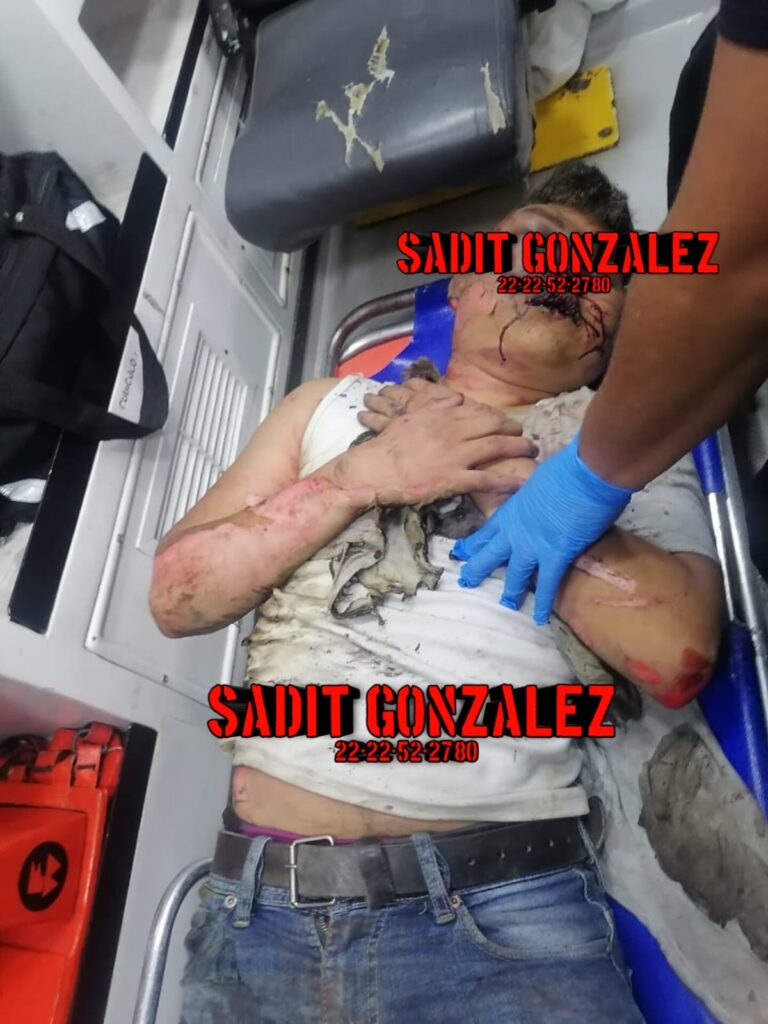 Por rata le prenden fuego y casi muere linchado en Xiutetelco