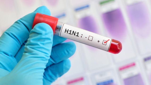 352 casos positivos, de estos predomina el contagio de la influenza A de subtipo H1N1 y la influenza B[4]