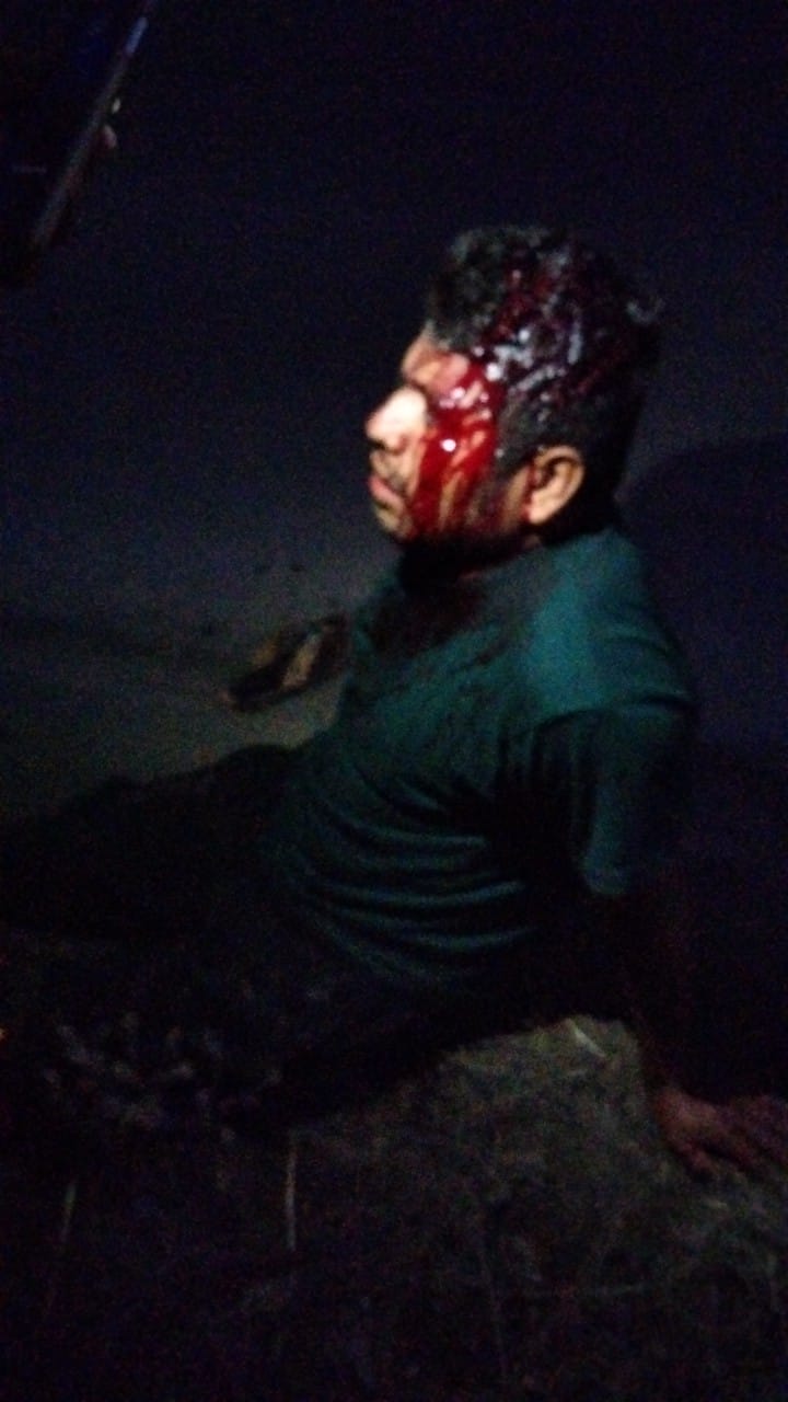Machetearon a un hombre en comunidad de Huauchinango