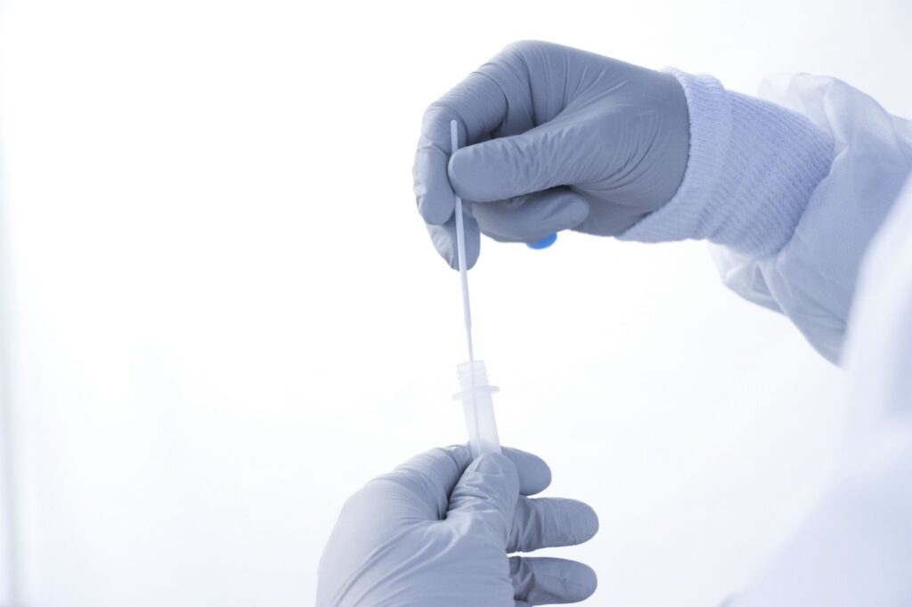 29 activos de covid-19 y 3 hospitalizados por influenza en Puebla