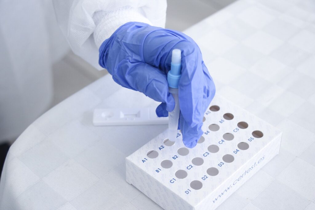 12 hospitalizados por covid e influenza en Puebla 