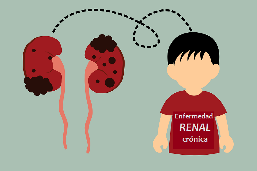 La enfermedad renal infantil puede prevenirse: experto