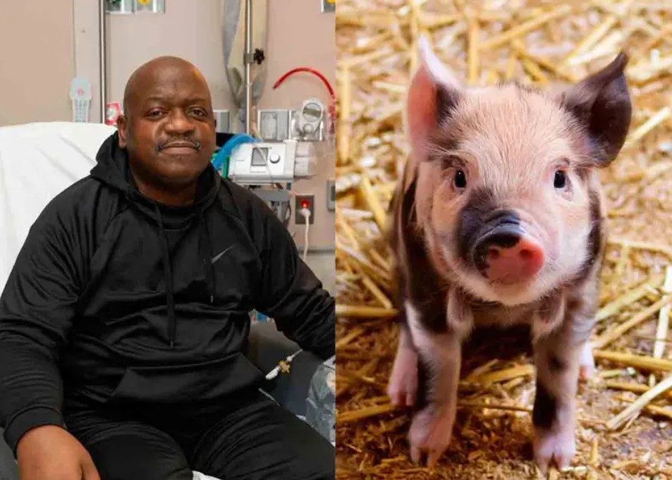 Muere paciente que recibió primer trasplante de riñón de cerdo genéticamente modificado