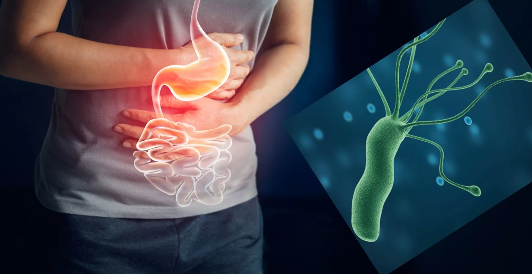 Siete de cada diez mexicanos viven con una bacteria responsable de gastritis crónica y cáncer de estómago