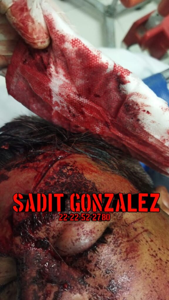 Simpatizantes del presidente electo de Tlatlauquitepec, Juan Manuel Téllez, se agarran a balazos por un hueso