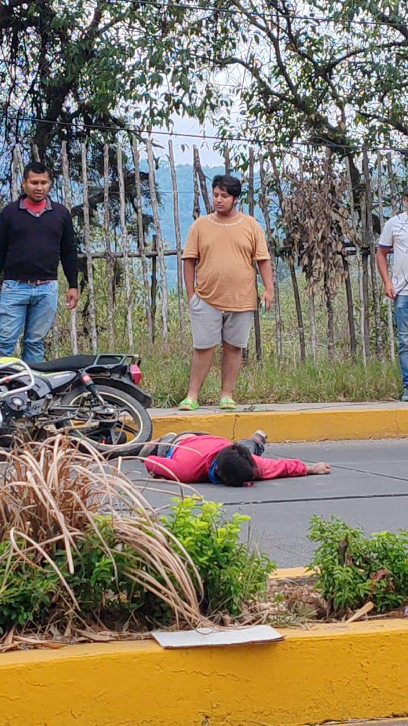 Motociclista herido en Huauchinango