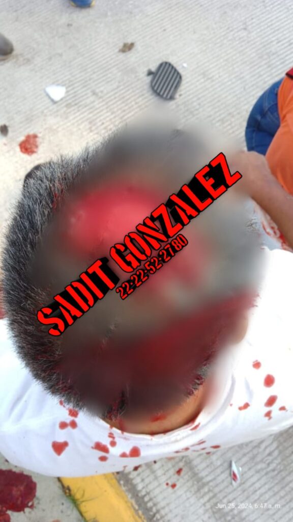 En Venustiano Carranza jóvenes presuntamente ebrios lesionan a operador de mototaxi