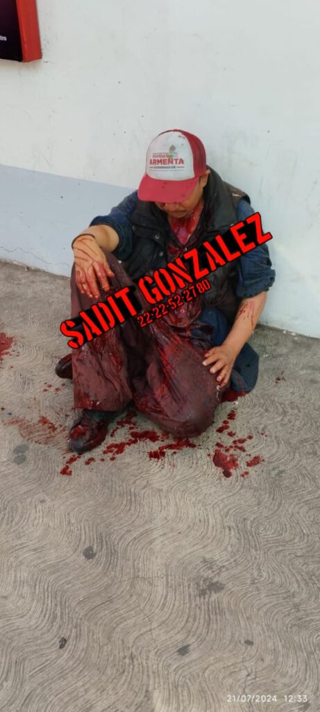 Entre la vida y la muerte apuñalado en el cuello en Texmelucan