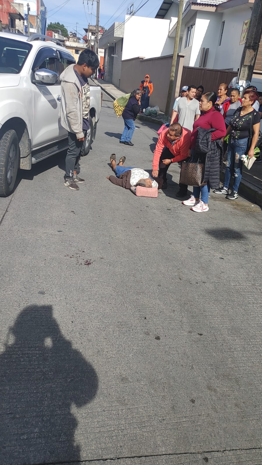 Mujer severamente lesionada atropellada por camioneta en Teziutlán