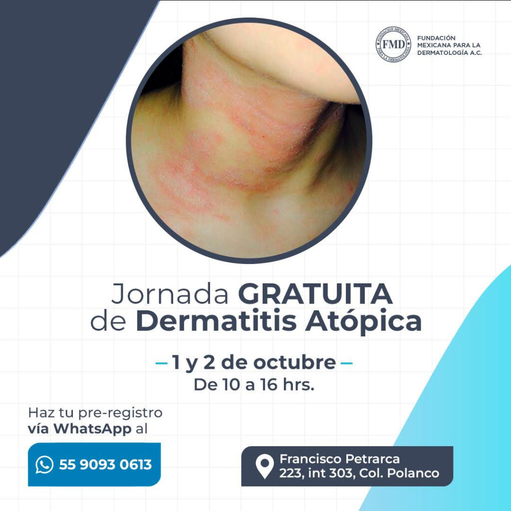 Realizará Fundación Mexicana para la Dermatología jornada gratuita de atención al paciente con Dermatitis Atópica en CDMX, el 1 y 2 de octubre