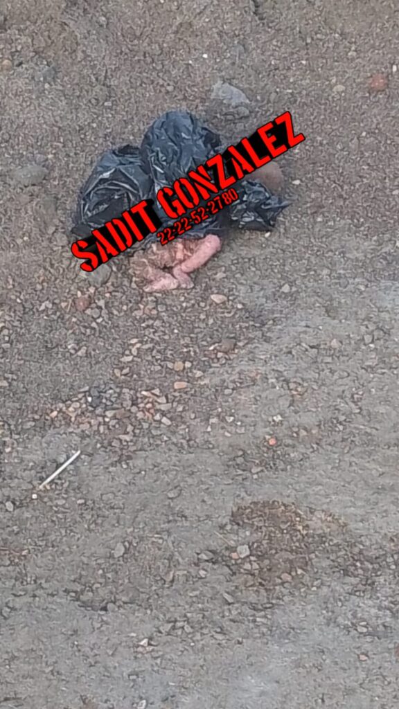 Video: Dejan feto semi enterrado en la Resurrección