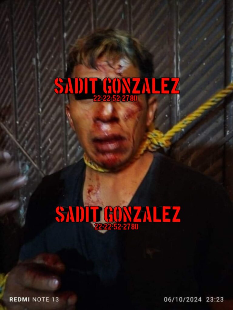 Fotonota: Hartos de la inseguridad, vecinos de San Nicolás Buenos Aires golpean a presunto ratero