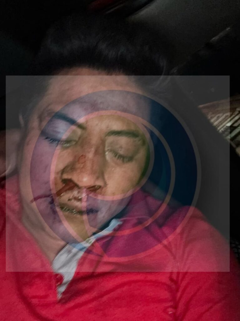 ¡A batazos “atienden” a clientes en antro de la avenida Juárez”